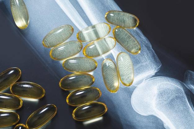 Jak działa Orton Flex glukozamina kolagen na stawy?