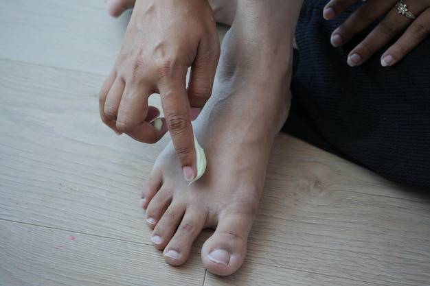 Jak działa Wortie preparat na kurzajki i brodawki?